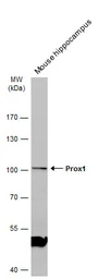 Anti-PROX1 antibody used in Western Blot (WB). GTX129143