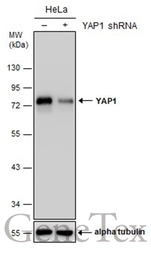 Anti-YAP1 antibody used in Western Blot (WB). GTX129151