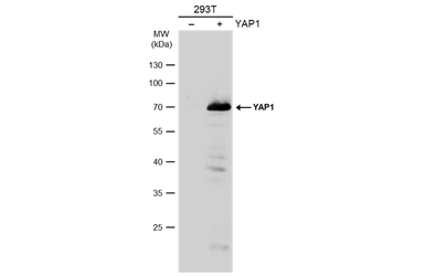 Anti-YAP1 antibody used in Western Blot (WB). GTX129151