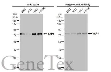 Anti-YAP1 antibody used in Western Blot (WB). GTX129151