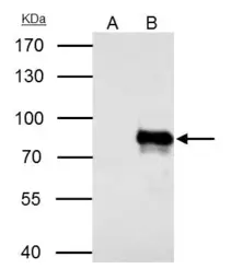 Anti-YAP1 antibody used in Immunoprecipitation (IP). GTX129151