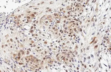 Anti-YAP1 antibody used in IHC (Paraffin sections) (IHC-P). GTX129151