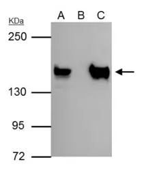 Anti-SIN3A antibody used in Immunoprecipitation (IP). GTX129156