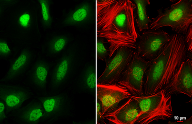 Anti-SIN3A antibody used in Immunocytochemistry/ Immunofluorescence (ICC/IF). GTX129156