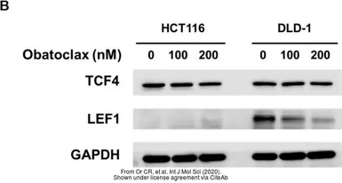 Anti-LEF1 antibody used in Western Blot (WB). GTX129186