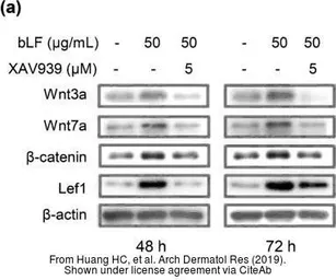 Anti-LEF1 antibody used in Western Blot (WB). GTX129186