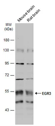 Anti-EGR3 antibody used in Western Blot (WB). GTX129199