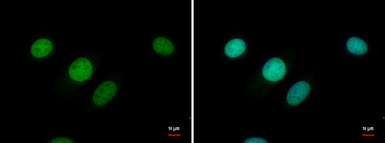 Anti-ER81 antibody used in Immunocytochemistry/ Immunofluorescence (ICC/IF). GTX129202