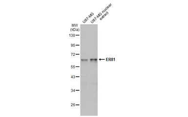 Anti-ER81 antibody used in Western Blot (WB). GTX129202