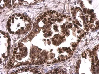 Anti-MCM6 antibody used in IHC (Paraffin sections) (IHC-P). GTX129216