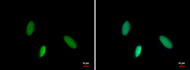 Anti-MCM6 antibody used in Immunocytochemistry/ Immunofluorescence (ICC/IF). GTX129217