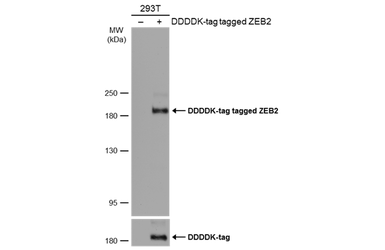Anti-ZEB2 antibody used in Western Blot (WB). GTX129243