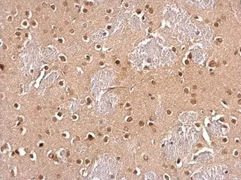 Anti-UBE2I antibody used in IHC (Paraffin sections) (IHC-P). GTX129293