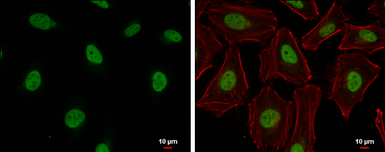 Anti-Cullin 4b antibody used in Immunocytochemistry/ Immunofluorescence (ICC/IF). GTX129298