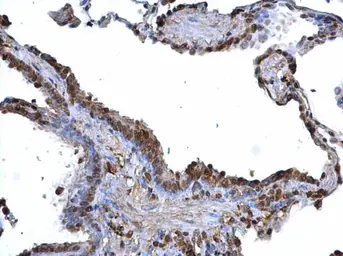 Anti-ARID3B antibody used in IHC (Paraffin sections) (IHC-P). GTX129352