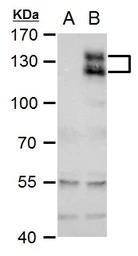 Anti-AXL antibody used in Western Blot (WB). GTX129407