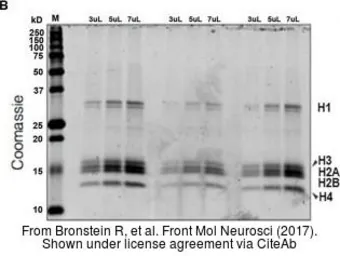 Anti-Histone H2A antibody used in Western Blot (WB). GTX129418