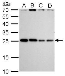 Anti-HMGB2 antibody used in Western Blot (WB). GTX129464