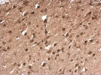 Anti-TLX3 antibody used in IHC (Paraffin sections) (IHC-P). GTX129465