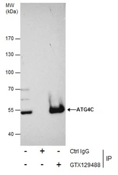 Anti-ATG4C antibody used in Immunoprecipitation (IP). GTX129488