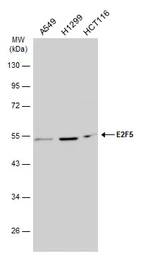 Anti-E2F5 antibody used in Western Blot (WB). GTX129491