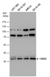 Anti-GBX2 antibody used in Western Blot (WB). GTX129494