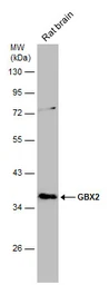Anti-GBX2 antibody used in Western Blot (WB). GTX129494