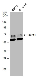 Anti-SOX11 antibody used in Western Blot (WB). GTX129501