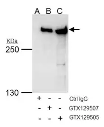 Anti-TRRAP antibody used in Immunoprecipitation (IP). GTX129507