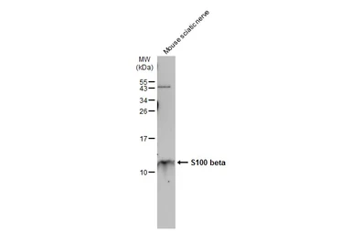 Anti-S100 beta antibody used in Western Blot (WB). GTX129573