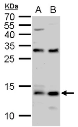Anti-S100A9 antibody used in Western Blot (WB). GTX129575