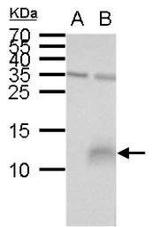 Anti-Elafin antibody used in Western Blot (WB). GTX129581