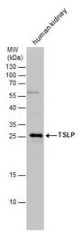 Anti-TSLP antibody used in Western Blot (WB). GTX129591