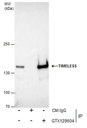 Anti-Timeless antibody used in Immunoprecipitation (IP). GTX129604
