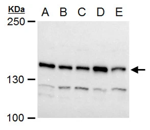 Anti-Timeless antibody used in Western Blot (WB). GTX129604