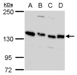 Anti-Timeless antibody used in Western Blot (WB). GTX129604