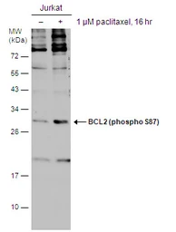 Anti-Bcl-2 (phospho Ser87) antibody used in Western Blot (WB). GTX129654