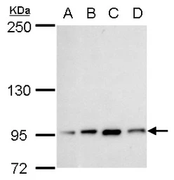 Anti-Transcription Termination Factor 1 antibody used in Western Blot (WB). GTX129671