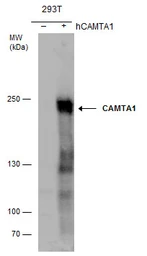 Anti-CAMTA1 antibody used in Western Blot (WB). GTX129686