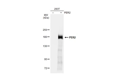 Anti-PER2 antibody used in Western Blot (WB). GTX129688