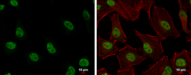 Anti-Histone H3K27me3 (Tri-methyl Lys27) antibody used in Immunocytochemistry/ Immunofluorescence (ICC/IF). GTX129774