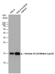 Anti-Histone H3K27me3 (Tri-methyl Lys27) antibody used in Western Blot (WB). GTX129774