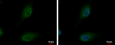 Anti-SON antibody used in Immunocytochemistry/ Immunofluorescence (ICC/IF). GTX129778