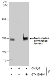 Anti-Transcription Termination Factor 1 antibody used in Immunoprecipitation (IP). GTX129804