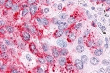 Anti-ERR alpha antibody used in IHC (Paraffin sections) (IHC-P). GTX12984