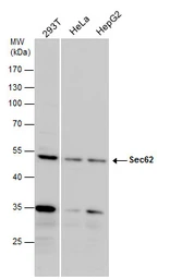 Anti-Sec62 antibody used in Western Blot (WB). GTX129853