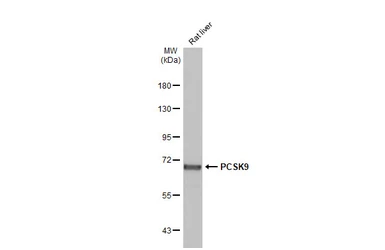 Anti-PCSK9 antibody used in Western Blot (WB). GTX129859