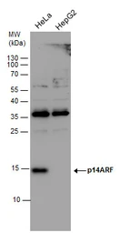 Anti-CDKN2A / p14ARF antibody used in Western Blot (WB). GTX129902
