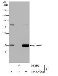 Anti-CDKN2A / p14ARF antibody used in Immunoprecipitation (IP). GTX129902