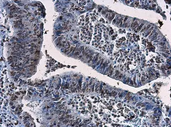 Anti-CDKN2A / p14ARF antibody used in IHC (Paraffin sections) (IHC-P). GTX129902